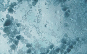 Symbolbild Graupelgewitter Ende März 2026